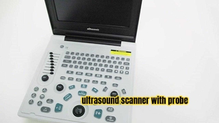 apparecchiature mediche Saferlife Scanner a ultrasuoni